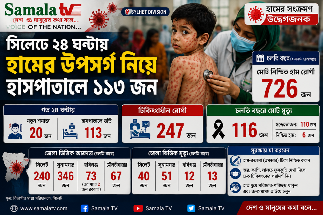 সিলেটে হামের প্রকোপ অব্যাহত: ২৪ ঘণ্টায় হাসপাতালে ভর্তি ১১৩, নতুন শনাক্ত ২০